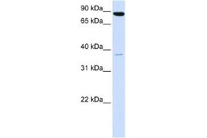 Synaptophysin antibody used at 1 ug/ml to detect target protein.