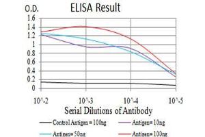 Black line: Control Antigen (100 ng),Purple line: Antigen (10 ng), Blue line: Antigen (50 ng), Red line:Antigen (100 ng)