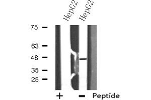 Western blot analysis of extracts from HepG2 cells using E2F2 antibody. (E2F2 anticorps  (Internal Region))