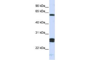 Western Blotting (WB) image for anti-Hyaluronan Binding Protein 2 (HABP2) antibody (ABIN2459800) (HABP2 anticorps)