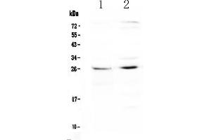 Western blot analysis of SLC31A1/CTR1 using anti-SLC31A1/CTR1 antibody . (SLC31A1 anticorps)