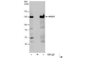 IP Image Immunoprecipitation of RAD21 protein from Jurkat whole cell extracts using 5 μg of RAD21 antibody, Western blot analysis was performed using RAD21 antibody, EasyBlot anti-Rabbit IgG  was used as a secondary reagent.