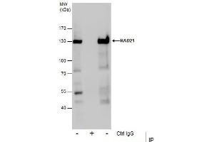IP Image Immunoprecipitation of RAD21 protein from Jurkat whole cell extracts using 5 μg of RAD21 antibody, Western blot analysis was performed using RAD21 antibody, EasyBlot anti-Rabbit IgG  was used as a secondary reagent. (RAD21 anticorps  (Center))