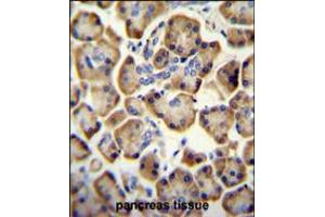 RADIL antibody immunohistochemistry analysis in formalin fixed and paraffin embedded human pancreas tissue followed by peroxidase conjugation of the secondary antibody and DAB staining.