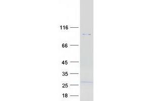 Validation with Western Blot