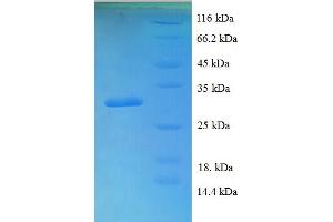 SDS-PAGE (SDS) image for Bone Morphogenetic Protein 4 (BMP4) (AA 293-408) protein (His-SUMO Tag) (ABIN5709145)