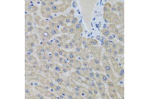 Immunohistochemistry of paraffin-embedded human liver using EIF2S3 antibody at dilution of 1:100 (x40 lens). (EIF2S3 anticorps)