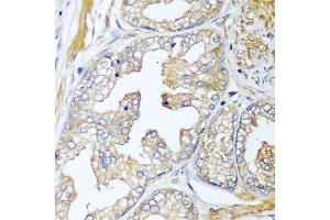 Immunohistochemistry of paraffin-embedded human prostate using CFD antibody at dilution of 1:100 (40x lens). (Adipsin anticorps)