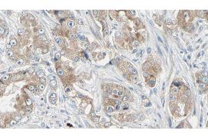 ABIN6279041 at 1/100 staining Human prostate tissue by IHC-P. (RPL18A anticorps  (Internal Region))