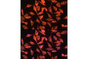Immunofluorescence analysis of L929 cells using PITPNA Rabbit pAb (ABIN6132492, ABIN6145687, ABIN6145688 and ABIN6216795) at dilution of 1:100 (40x lens).