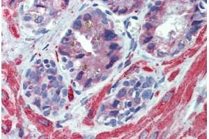 Prostate, Human: Formalin-Fixed, Paraffin-Embedded (FFPE)