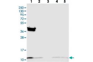 Western blot analysis of Lane 1: RT-4, Lane 2: U-251 MG, Lane 3: Human Plasma, Lane 4: Liver, Lane 5: Tonsil with TIMM10 polyclonal antibody  at 1:250-1:500 dilution. (TIMM10 anticorps)
