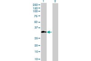 Western Blot analysis of METTL1 expression in transfected 293T cell line ( H00004234-T01 ) by METTL1 MaxPab polyclonal antibody. (METTL1 anticorps  (AA 1-276))