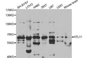 Western Blotting (WB) image for anti-Atlastin GTPase 1 (ATL1) antibody (ABIN1876490) (ATL1 anticorps)