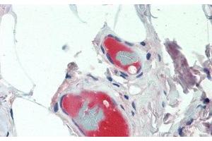 Detection of CP in Human Small Intestine Tissue using Monoclonal Antibody to Ceruloplasmin (CP) (Ceruloplasmin anticorps  (AA 789-1065))