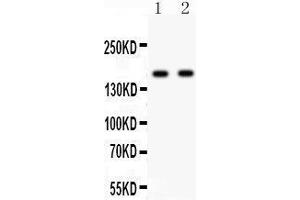 Anti- NMDAR2A Picoband antibody, Western blotting All lanes: Anti NMDAR2A  at 0.