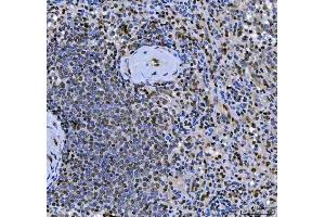 IHC analysis of SCML1 using anti-SCML1 antibody (ABIN7602479). (SCML1 anticorps  (AA 8-322))