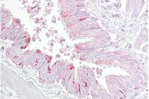 Immunohistochemistry with Lung, respiratory epithelium tissue at an antibody concentration of 5µg/ml using anti-PA2G4 antibody (ARP47601_P050) (PA2G4 anticorps  (C-Term))