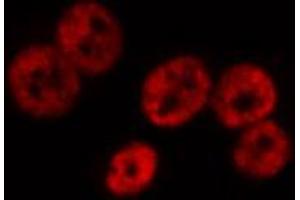 ABIN6267661 staining HeLa by IF/ICC.