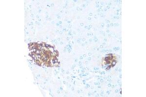 Immunohistochemistry of paraffin-embedded rat islets of langerhans using ODC1 antibody.