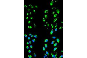Immunofluorescence analysis of HeLa cells using NFKBIA antibody.