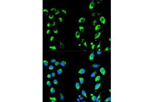 Immunofluorescence analysis of HeLa cells using NFKBIA antibody. (NFKBIA anticorps  (AA 1-317))