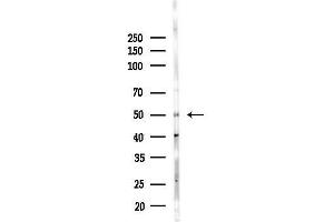 Western blot analysis of lysates from Hela cells(heat-shock,45 min treatment), using TYMP Antibody at 1/1000 dilution.