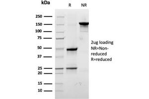SDS-PAGE Analysis Purified Laminin Receptor Monospecific Mouse Monoclonal Antibody (RPSA/2699).