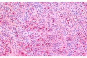 Immunohistochemistry analysis of paraffin-embedded Human Spleen using ITGAX Polyclonal Antibody.