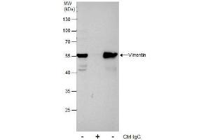 IP Image Immunoprecipitation of Vimentin protein from HeLa whole cell extracts using 5 μg of Vimentin antibody, Western blot analysis was performed using Vimentin antibody, EasyBlot anti-Rabbit IgG  was used as a secondary reagent. (Vimentin anticorps)