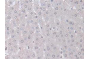 Detection of ITSN1 in Rat Liver Tissue using Polyclonal Antibody to Intersectin 1 (ITSN1)