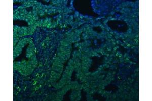 IF analysis of TRMT61A using anti-TRMT61A antibody (ABIN7599220). (TRMT61A anticorps  (AA 1-289))