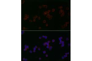Immunofluorescence analysis of 293T cells using Mitofusin 2 Rabbit pAb (ABIN6133825, ABIN6143800, ABIN6143803 and ABIN6216518) at dilution of 1:50 (40x lens).