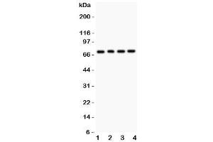 Western blot testing of FOXO1 antibody and Lane 1:  rat lung (FOXO1 anticorps  (AA 456-655))