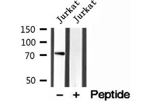 Western blot analysis of extracts of Jurkat cells, using VISA antibody. (MAVS anticorps  (C-Term))