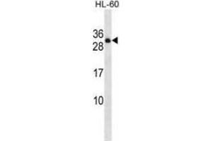 Western blot analysis in HL-60 cell line lysates (35ug/lane) using PTPRCAP / LPAP  Antibody . (PTPRCAP anticorps  (Middle Region))