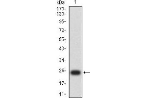 Western blot analysis using PSAP mAb against human PSAP (AA: 17-216) recombinant protein.