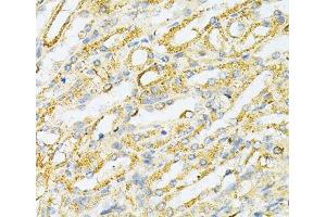 Immunohistochemistry of paraffin-embedded Mouse kidney using SULT2A1 Polyclonal Antibody at dilution of 1:200 (40x lens).