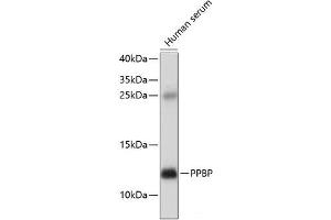 Western blot analysis of extracts of Human serum using PPBP Polyclonal Antibody at dilution of 1:1000. (CXCL7 anticorps)