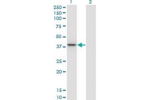 Western Blot analysis of PARVG expression in transfected 293T cell line by PARVG monoclonal antibody (M01A), clone 4E1. (PARVG anticorps  (AA 1-331))