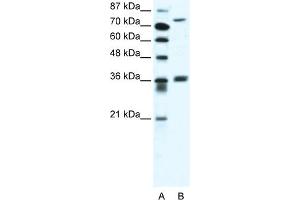 WB Suggested Anti-MID1 Antibody Titration:  2. (MID1 anticorps  (C-Term))
