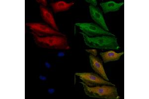 ABIN6264389 and ABIN6279692 staining  cells by IF/ICC. (PPP1R3D anticorps  (Internal Region))