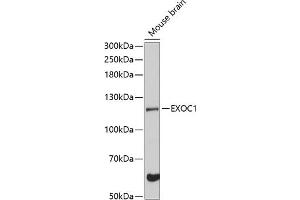 Western blot analysis of extracts of mouse brain, using EXOC1 Antibody (ABIN6129575, ABIN6140361, ABIN6140362 and ABIN6224778) at 1:3000 dilution. (EXOC1 anticorps  (AA 645-894))