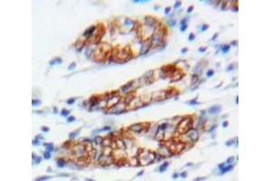 IHC-P analysis of Stomach tissue, with DAB staining. (Connexin 31 anticorps  (AA 211-269))