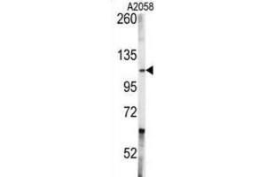 Western Blotting (WB) image for anti-C-Abl Oncogene 1, Non-Receptor tyrosine Kinase (ABL1) antibody (ABIN3003438) (ABL1 anticorps)