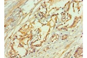 Immunohistochemistry of paraffin-embedded human prostate tissue using ABIN7167072 at dilution of 1:100 (MAPKSP1 anticorps  (AA 1-124))