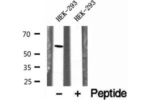 Western blot analysis of extracts of HEK-293 cells, using UGT2B7 antibody. (UGT2B7 anticorps)