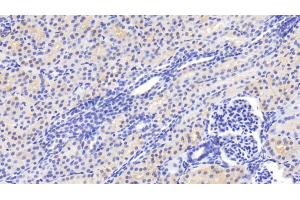 Detection of CASP2 in Human Kidney Tissue using Polyclonal Antibody to Caspase 2 (CASP2) (Caspase 2 anticorps  (AA 334-452))
