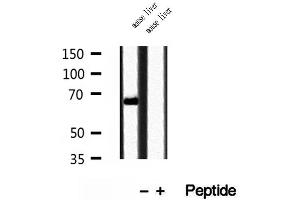 Western blot analysis of extracts of mouse liver tissue, using TOM70 antibody.