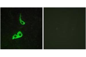 Immunofluorescence analysis of LOVO cells, using GPR153 Antibody. (GPR153 anticorps  (AA 195-244))